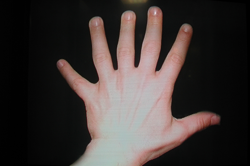 Video still of hand with 6 fingers